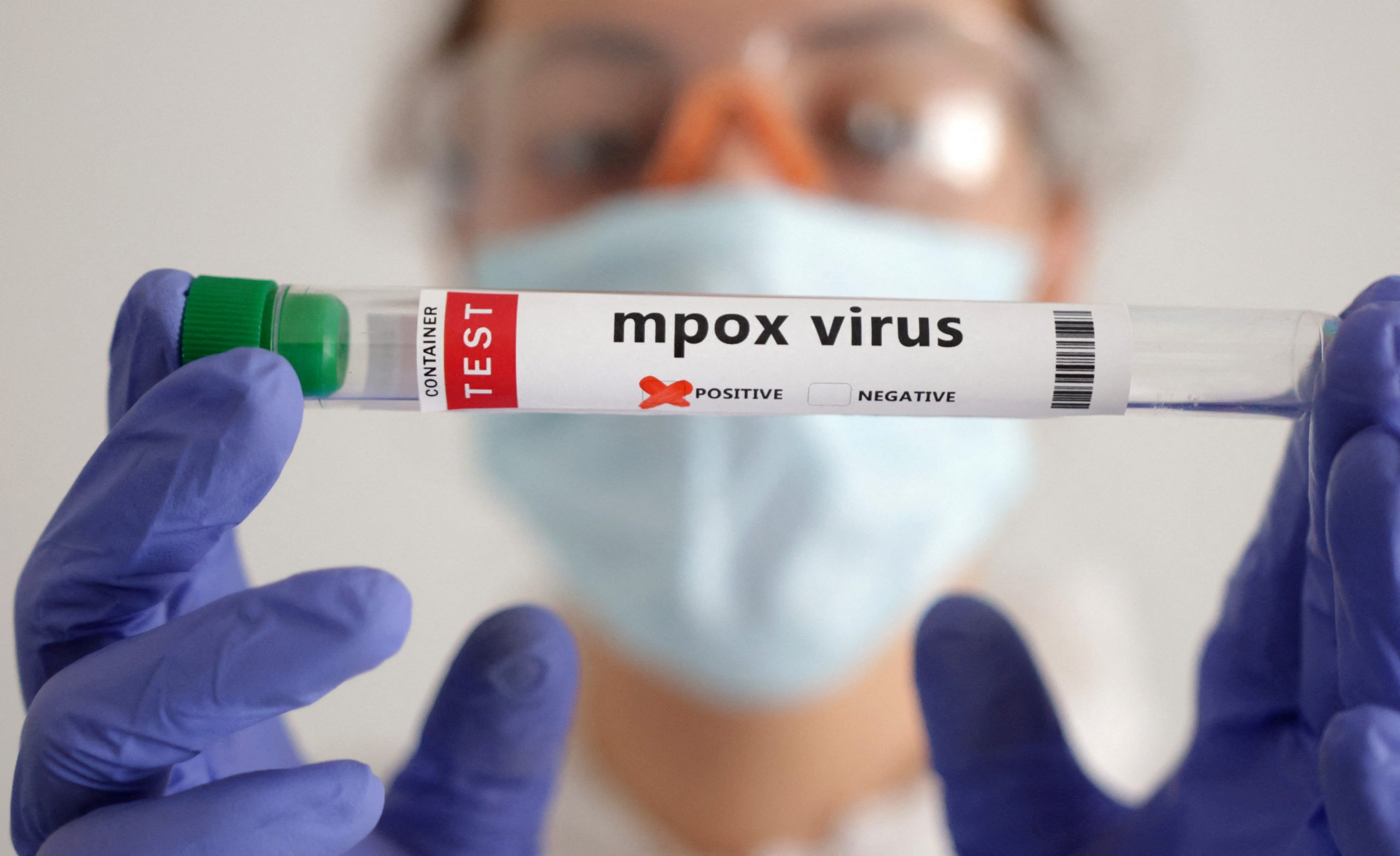 ΠΟΥ: Η mpox δεν είναι «ο νέος Covid», η ασθένεια μπορεί να σταματήσει