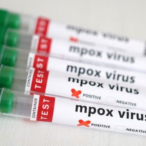 Ιός mpox: Επείγουσα σύγκληση του Παγκόσμιου Οργανισμού Υγείας – Τι προκαλεί ανησυχία